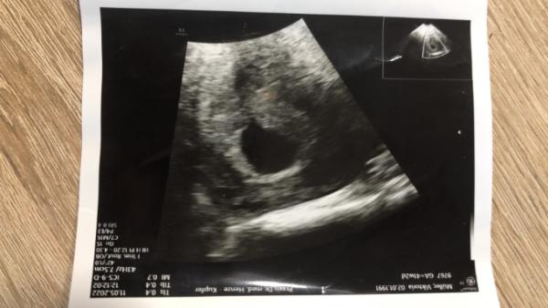Bild zu Wahrscheinlich twins - Forum für Januar - Mamis