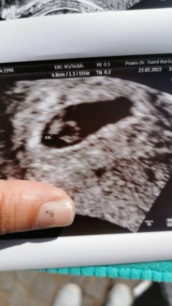 Bild zu Juhu, ein Herzschlag - Forum für Januar - Mamis