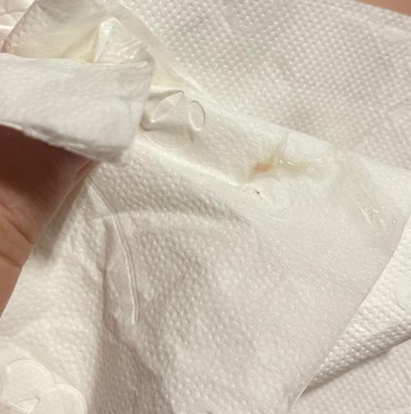 Bild zu Minimal rosa/orange am Toilettenpapier? - Forum für Januar - Mamis