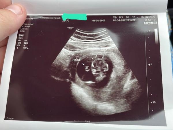 Bild zu Wir spekulieren noch - Forum für Januar - Mamis