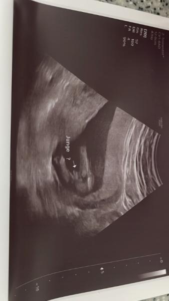 Bild zu Geschlecht - Forum für Januar - Mamis