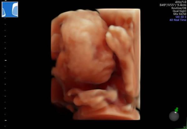 Bild zu Wir bekommen ein ... - Forum für Januar - Mamis