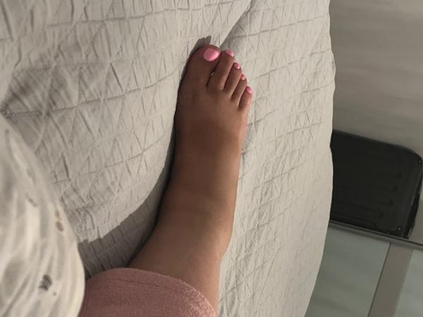 Bild zu Ich habe schöne dicke Beine 😩 - Forum für Januar - Mamis