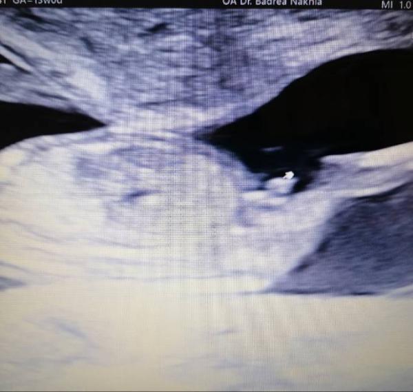 Bild zu Junge oder Mädchen - Forum für Januar - Mamis