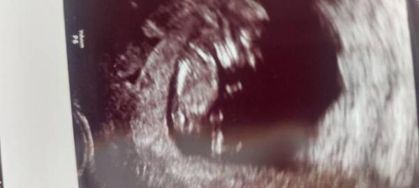 Bild zu Nub raten - Forum für Januar - Mamis