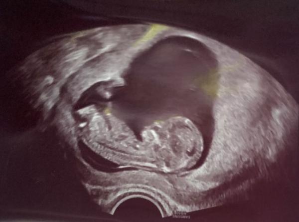 Bild zu Hallo :-) - Forum für Januar - Mamis