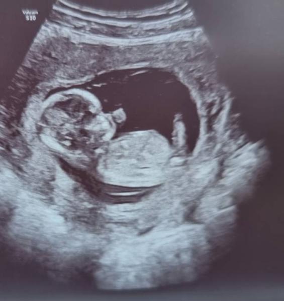 Bild zu Was würdet ihr tippen? - Forum für Januar - Mamis