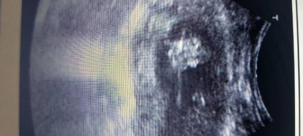 Bild zu Mädchen oder junge - Forum für Januar - Mamis