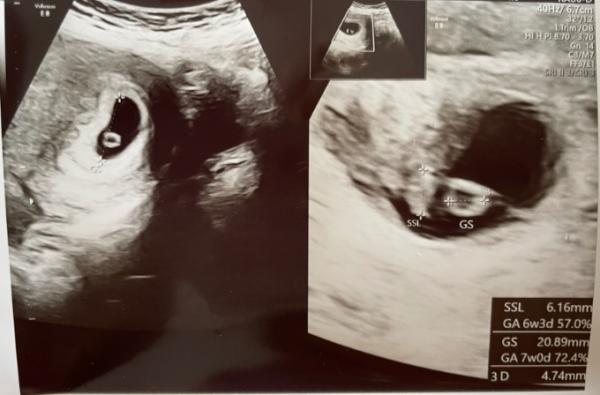 Bild zu Eckenhocker - Forum für Januar - Mamis