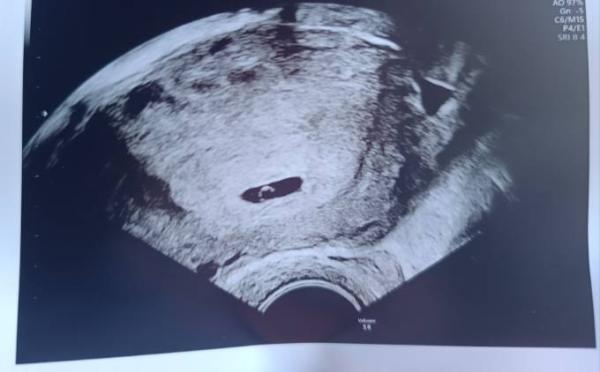 Bild zu 1. FA Termin mit Ultraschall - Forum für Januar - Mamis