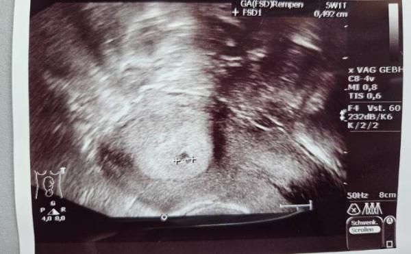Bild zu 1. Gyn Termin - Forum für Januar - Mamis