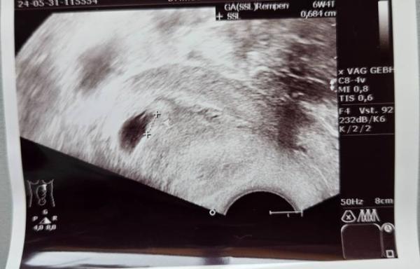 Bild zu Herzchen ❤️ - Forum für Januar - Mamis