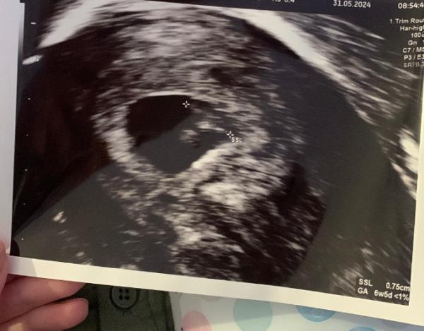 Bild zu Ultraschall 7+3 - Forum für Januar - Mamis