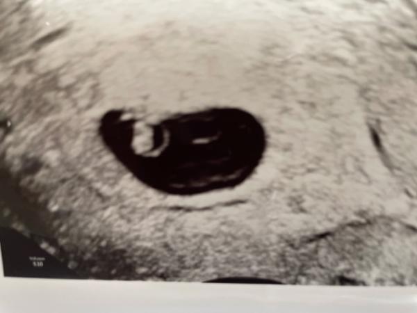 Bild zu Rückdatiert um 10 Tage?! - Forum für Januar - Mamis