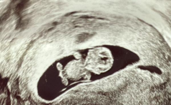 Bild zu 3 cm ❤️ - Forum für Januar - Mamis