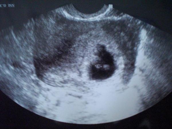 Bild zu bildchen :) - Forum für Februar - Mamis