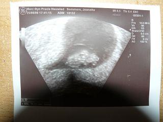 Bild zu das erste bildchen freuuu - Forum für Februar - Mamis