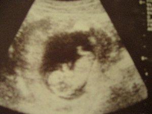Bild zu @Alle... - Forum für Februar - Mamis