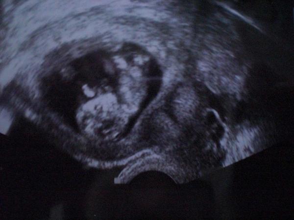 Bild zu hier noch ein bildchen :) - Forum für Februar - Mamis