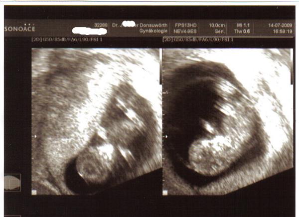 Bild zu Mein Minimi - Forum für Februar - Mamis
