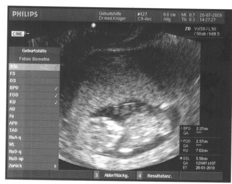 Bild zu FA Bericht+bild - Forum für Februar - Mamis
