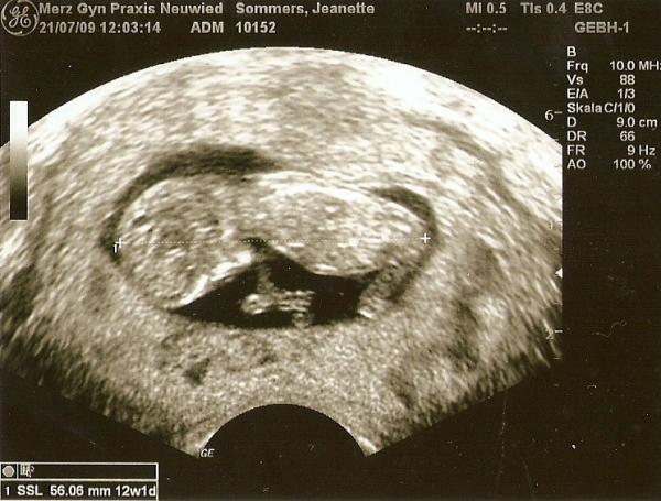 Bild zu mein neues bildchen von meiner Motte - Forum für Februar - Mamis