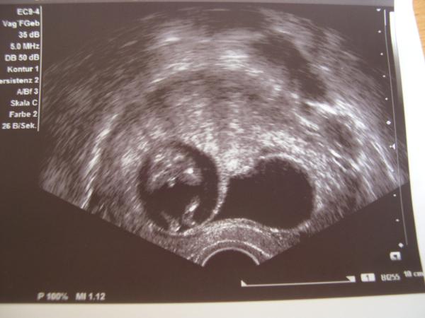 Bild zu ich hab noch Bildchen - Forum für Februar - Mamis