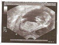 Bild zu Hab ich euch schonnen meinen Bauchzwerg gezeigt? - Forum für Februar - Mamis