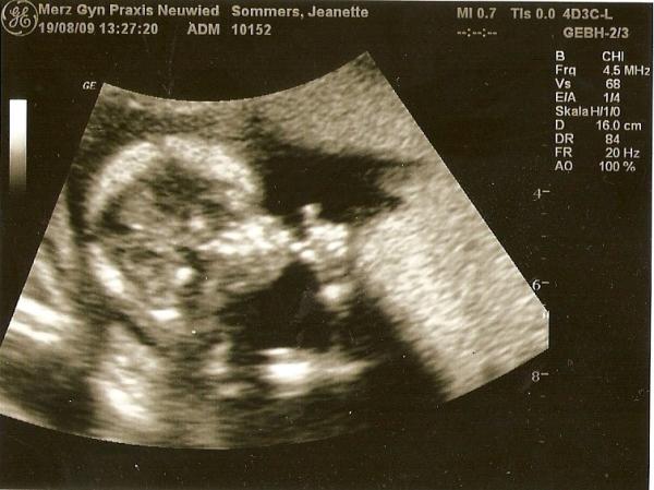 Bild zu mein bildchen - Forum für Februar - Mamis