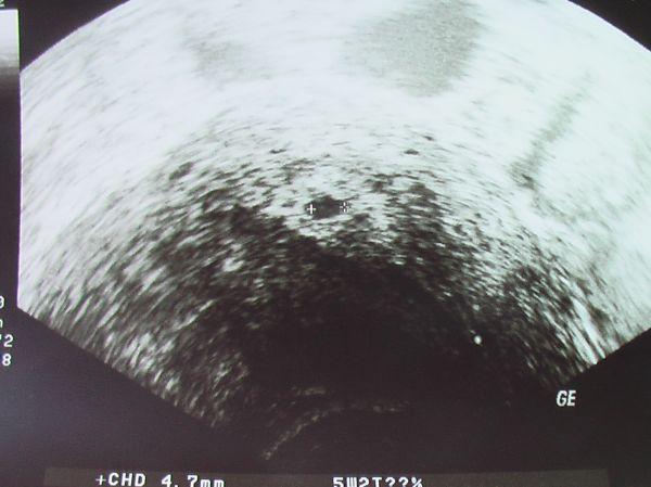 Bild zu Hallo ich bin wieder zurück :-) - Forum für Februar - Mamis