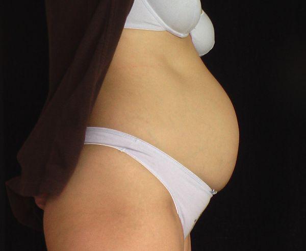 Bild zu Bauchbild 3 - Forum für Februar - Mamis