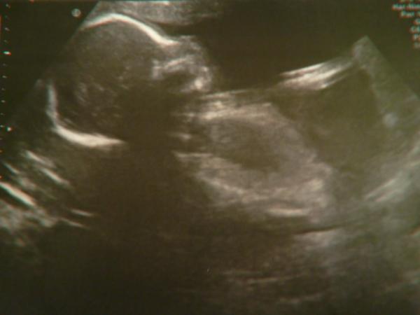 Bild zu Hier noch die Bilder meiner VU gerstern :) - Forum für Februar - Mamis