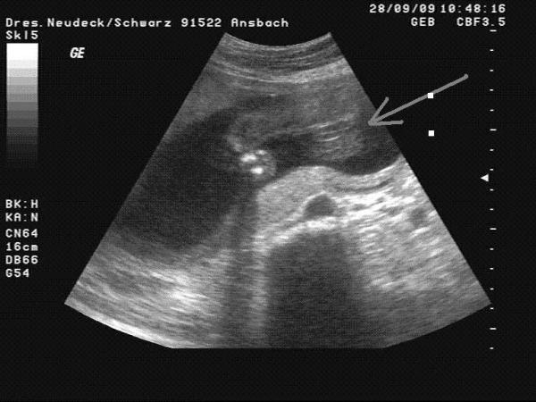 Bild zu Hab eben das Ultraschalbild bekommen. - Forum für Februar - Mamis