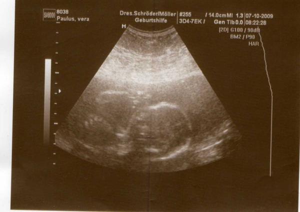 Bild zu Guten morgen !! - Forum für Februar - Mamis