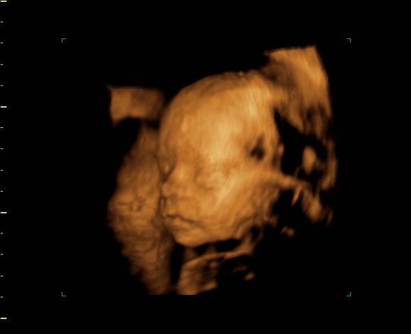 Bild zu bilder von meinem prinzen - Forum für Februar - Mamis