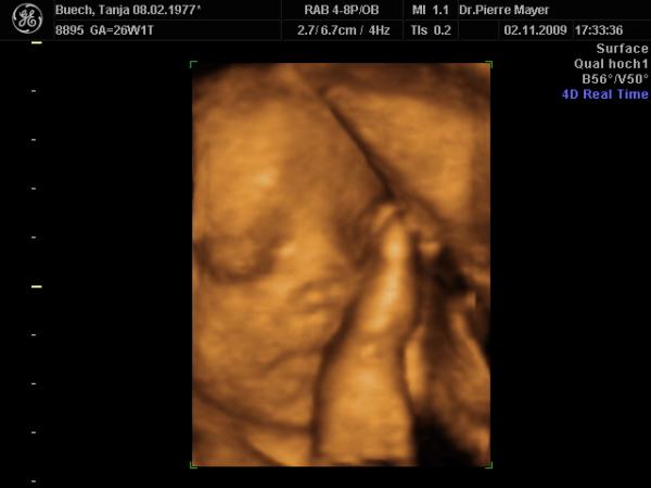 Bild zu so hier die Bilder..... - Forum für Februar - Mamis