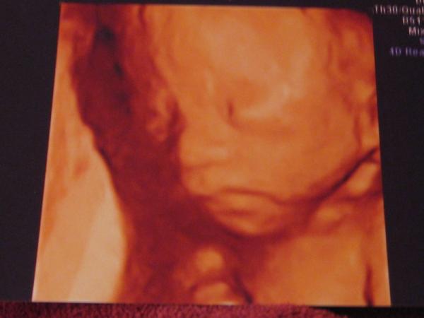 Bild zu neues bild - Forum für Februar - Mamis