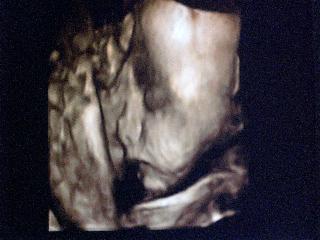 Bild zu Unser Schatzi - Forum für Februar - Mamis