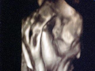 Bild zu Fa Termin + Zuckertest - Forum für Februar - Mamis