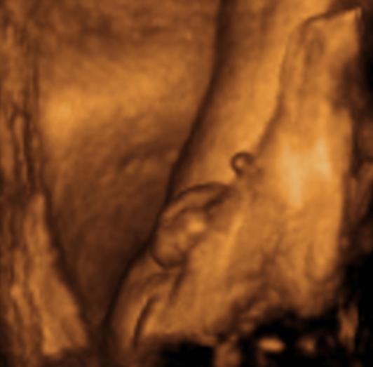 Bild zu das lang ersehnte outing :-) - Forum für Februar - Mamis