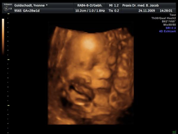 Bild zu 3D/4D US...wer schauen mag:-) - Forum für Februar - Mamis