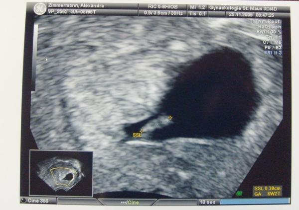 Bild zu Mein neues Baby :) - Forum für Februar - Mamis