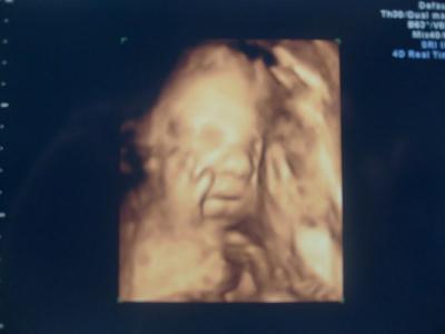 Bild zu Letzter Ultraschall - Forum für Februar - Mamis