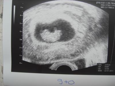 Bild zu Grade VU beim FA - Forum für Februar - Mamis