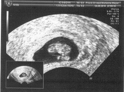 Bild zu Zurück vom Fotoshooting beim FA - Forum für Februar - Mamis