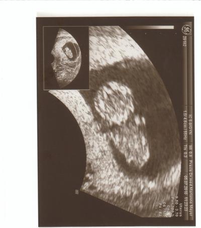 Bild zu Zurück vom FA! - Forum für Februar - Mamis