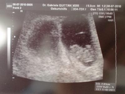 Bild zu hier baby 1 - Forum für Februar - Mamis