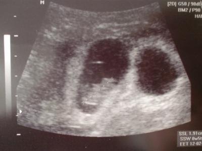 Bild zu und baby nr. 2 - Forum für Februar - Mamis