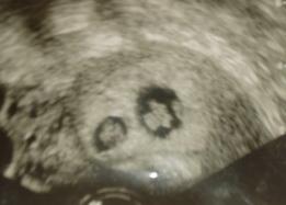 Bild zu Hallo - Forum für Februar - Mamis