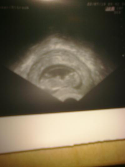 Bild zu Hatte heute FA Termin, Krümel ist voll groß! - Forum für Februar - Mamis